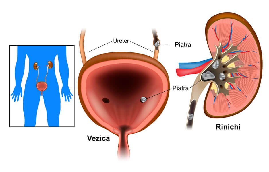 urinare frecventă și abundentă la bărbați metoda de tratament a prostatitei